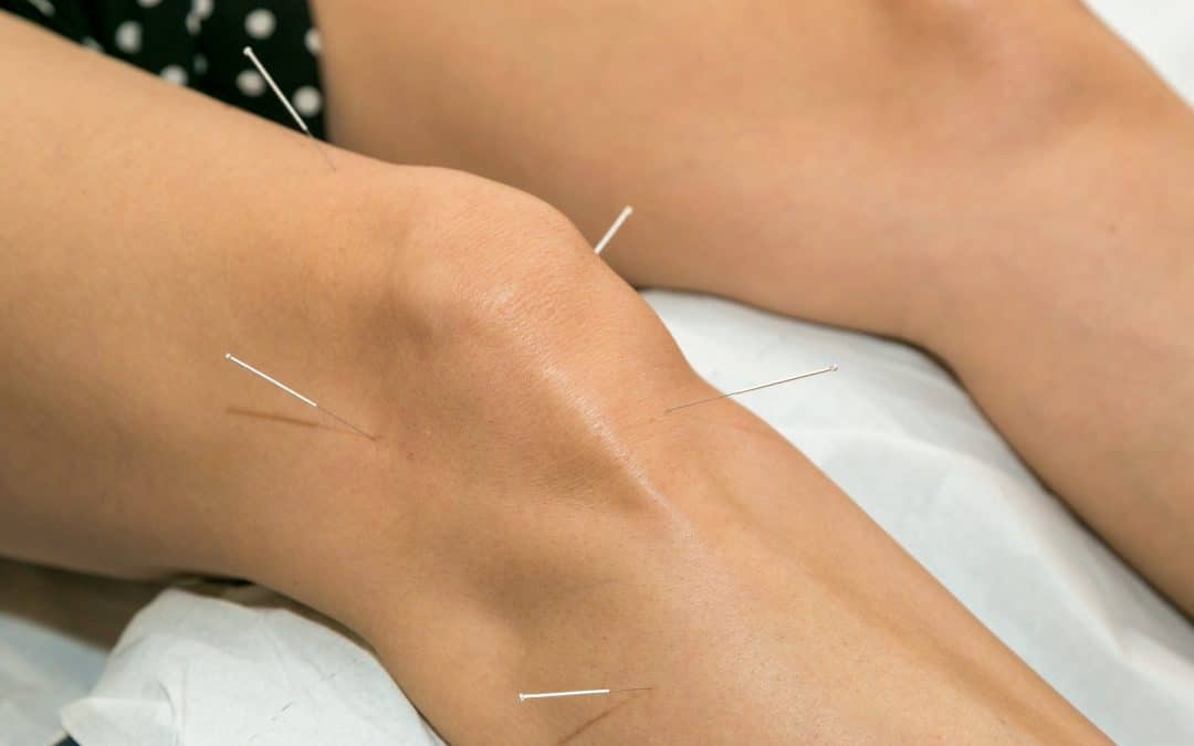 World Osteoporosis Day: Down to the Bone with TCM