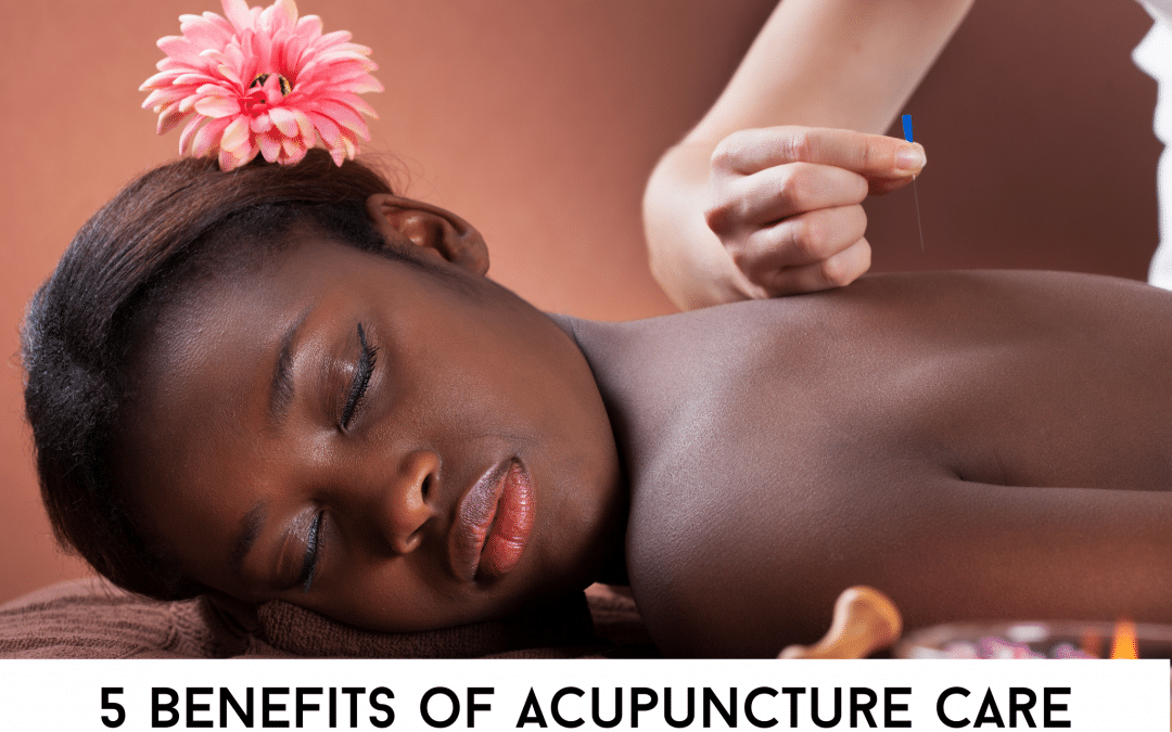 5 Benefits of Acupuncture Care